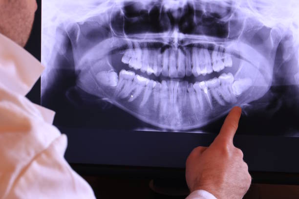 Best Urgent Dental Care for Toothache in Frankfort, MI