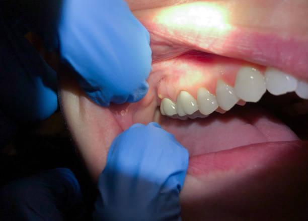 Best Emergency Cosmetic Dentistry in Frankfort, MI