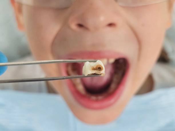 Best Emergency Dentist for Knocked-Out Tooth in Frankfort, MI