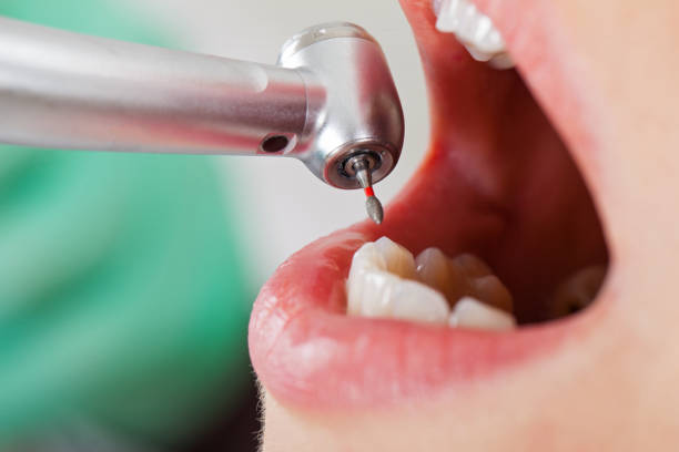 Best Emergency Dental Services for Seniors in Frankfort, MI